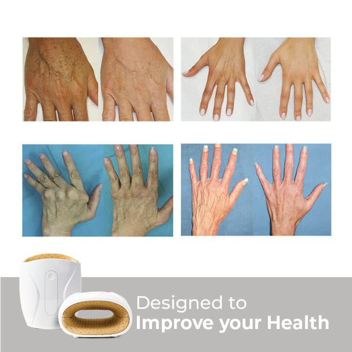 1x Pain Free UK™ Hand Massager - Quick Relief for Hand Pain in Just 15 Minutes a Day*