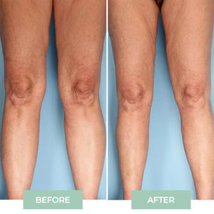 4x Pain Free UK™ Knee Massager - Temporary Relief From Joint Pain in Just 15 Minutes a Day*